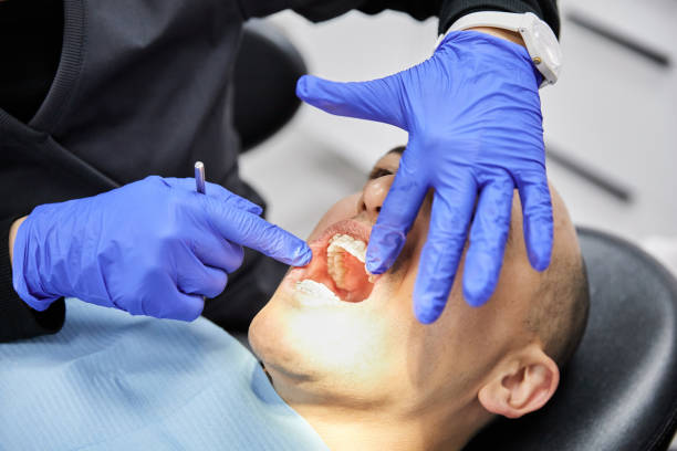 Best Urgent Tooth Repair  in Strawberry Point, IA
